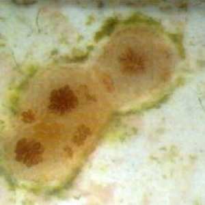 Acropora palmata settlements(weeks old through scope)